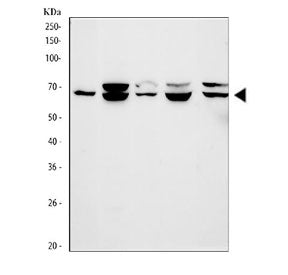 Western blot testing of 1) human HCCT, 2) human HepG2, 3) human HUH7, 4) rat liver and 5) mouse live