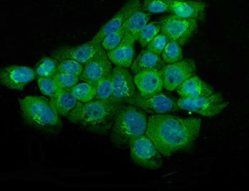 NSE Antibody / Neuron Specific Enolase