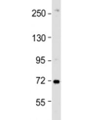 ZDHHC17 Antibody