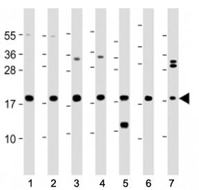 Western blot testing of ARPC5 antibody at 1:2000 with human lysates 1: THP-1, 2: HL-60, 3: HeLa, 4: