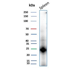 Western blot testing of human spleen tissue lysate with CD161 antibody. Predicted molecular weight ~