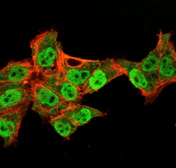 p40 / deltaNp63 Antibody