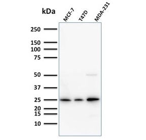 Western blot testing of human samples with Mammaglobin antibody (clone SPM518). Expected molecular w