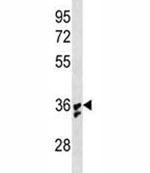 IL-1B antibody 293 cell lysate transiently transfected with the IL1B gene. Predicted molecular weigh