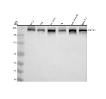 Western blot analysis of RB1CC1 using anti-RB1CC1 antibody. Electrophoresis was performed on a 8% SD