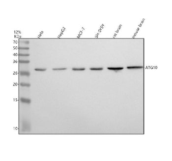 Western blot analysis of ATG10 using anti-ATG10 antibody. Lane 1: human Hela whole cell lysates, Lan
