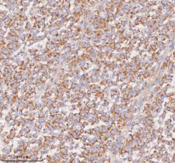 Immunohistochemical staining of SLC14A1 using anti-SLC14A1 antibody. SLC14A1 was detected in a paraf
