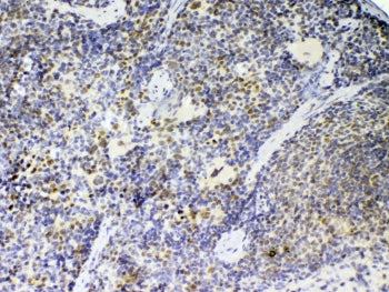 IHC testing of FFPE mouse spleen tissue with Ptpn22 antibody at 1ug/ml. Required HIER: steam section