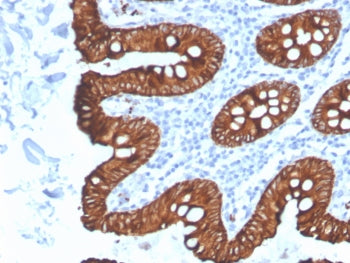 IHC testing of FFPE human colon tissue with recombinant Cytokeratin 8 antibody (clone KRT8/4067R). R