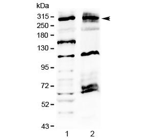 Western blot testing of human 1) U-2 OS and 2) MCF7 cell lysate with MED13 antibody at 0.5ug/ml. Pre