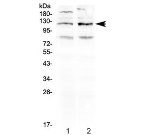 GABA B Receptor 1 Antibody / GABBR1