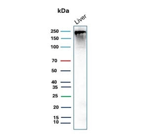 Western blot testing of human liver tissue lysate with CPS1 antibody (clone CPS1/9868). Predicted mo