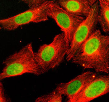 Immunofluorescent staining of Histone H4 using anti-Histone H4 antibody (green) and anti-Beta Tubuli