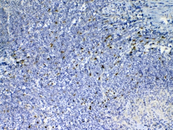 Il-33 Antibody