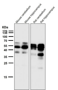 All lanes use the Phospho-Tau (Ser404) antibody at 1:2K dilution for 1 hour at room temperature. The