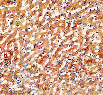 IHC analysis of SLC46A3 using anti-SLC46A3 antibody. SLC46A3 was detected in a paraffin-embedded sec