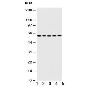Western blot testing of Iduronate 2 sulfatase antibody and Lane 1: HeLa; 2: SMMC-7721; 3: A549; 4: M