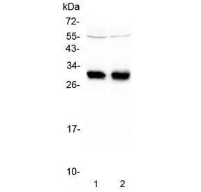 HLA-DRB1 Antibody (MHC II)