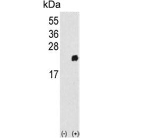 Western blot testing of 1) non-transfected and 2) transfected 293 cell lysate with Peroxiredoxin 1 a