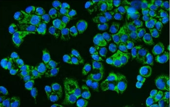 Immunofluorescent staining of FFPE human T-47D cells with CD46 antibody (green) and DAPI nuclear sta