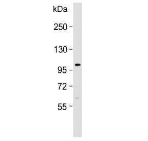 Western blot testing of human HepG2 cell lysate with FGFR4 antibody. Expected molecular weight: 88~1