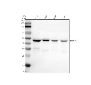 Western blot analysis of SNAP47 using anti-SNAP47 antibody. Electrophoresis was performed on a 10% S