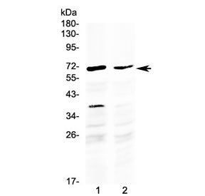 Western blot testing of human 1) HepG2 and 2) MCF7 cell lysate with MAK antibody at 0.5ug/ml. Predic