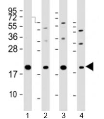 Western blot testing of human 1) HeLa, 2) PC-3, 3) T47D and 4) U-2OS cell lysate with APC11 antibody