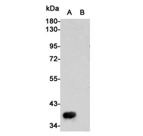 Western blot testing of c-Met A) transfected (partial protein) and (B) untransfected CHO-K1 cell lys