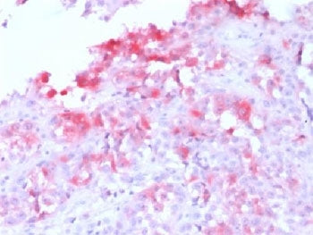 MART-1 / Melan-A Antibody