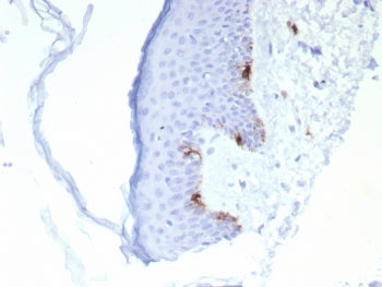 IHC staining of FFPE human skin tissue with MART-1 antibody (clone rMLANA/8134). HIER: boil tissue s