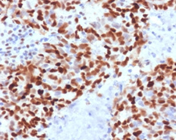 MSH6 Antibody