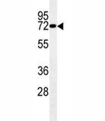 LIM Kinase 1 Antibody / LIMK1, 0.4ml