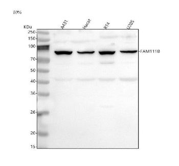 Western blot analysis of FAM111B using anti-FAM111B antibody. Lane 1: human whole cell lysates, Lane