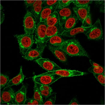 Immunofluorescent staining of permeabilized human HeLa cells with Beta-2 Microglobulin antibody (gre