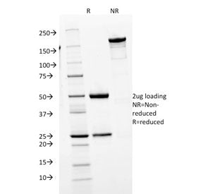 IgM Heavy Chain Antibody