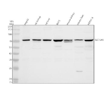 Western blot analysis of SLC15A5 using anti-SLC15A5 antibody. Electrophoresis was performed on a 10%