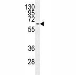 MAPK15 Antibody, 0.08ml