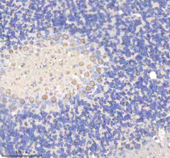 Immunohistochemical staining of YWHAH using anti-YWHAH antibody. YWHAH was detected in a paraffin-em