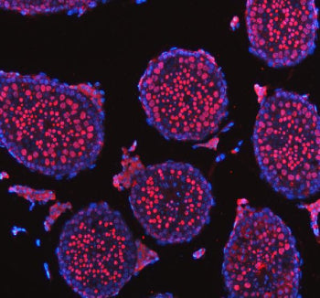 Immunofluorescent staining of NASP using anti-NASP antibody (red). NASP was detected in a paraffin-e