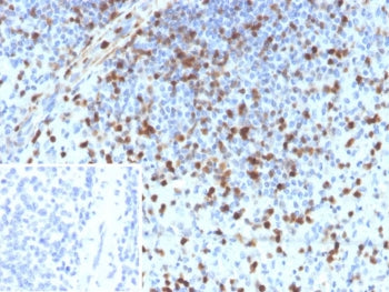 IHC staining of FFPE human spleen tissue with S100A4 antibody (clone S100A4/6796). Inset: PBS used i