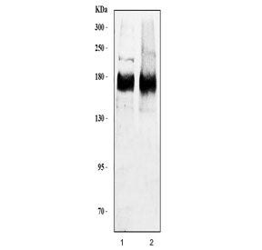 HER2 / ErbB 2Antibody