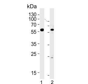 FANCC Antibody / Fanconi anemia group C protein