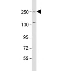 Western blot testing of mouse brain lysate with SPTBN1 antibody at 1:1000. Predicted molecular weigh