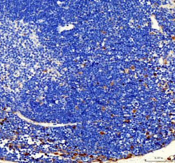 IHC analysis of FUBP1 using anti-FUBP1 antibody. FUBP1 was detected in a paraffin-embedded section o