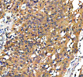 Immunohistochemical staining of GPD1 using anti-GPD1 antibody. GPD1 was detected in a paraffin-embed