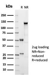 SDS-PAGE analysis of purified, BSA-free recombinant ER beta 1 antibody (clone ESR2/7006R) as confirm
