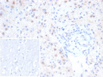 IHC staining of FFPE human brain tissue with EBAG9 antibody (clone rEBAG9/7264). Inset: PBS used in