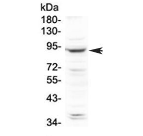 PLA2G6 Antibody / CaI-PLA2