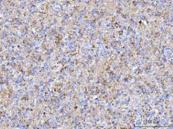 HBBM Antibody / Heparin-binding brain mitogen / Pleiotrophin